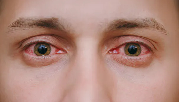 pineapples,pineapples benefits,pineapples health benefits,healthy food pineapples,pineapples for good health,healthy food pineapples benefits,pineapples for better health,Health tips