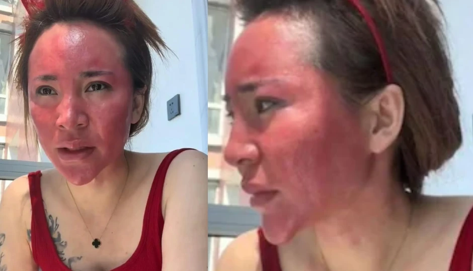 22 साल से नहीं हटाया चेहरे का मेकअप! महिला की हालत देख कांप उठे लोग – जानिए पूरी कहानी woman wore makeup 22 years,makeup allergy case,makeup without removal danger,skin damage from makeup,viral makeup story china,makeup hygiene tips,face swelling due to makeup,skincare after makeup,facewash importance after makeup