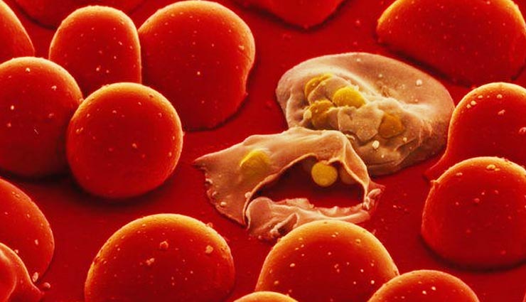 मलेरिया होने पर करें ये घरेलु उपचार होगा फायदा... home remedies,tips to treat malaria,malaria,Health tips,healthy living