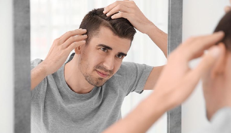 7 Surprising Remedies To Treat Male Baldness
