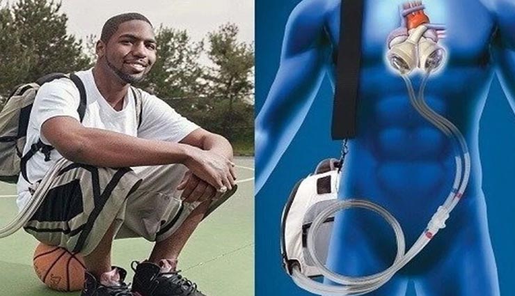 आखिर बिना दिल के कैसे 555 दिनों तक जिंदा रह पाया ये शख्स, जानकर रह जाएंगे हैरान