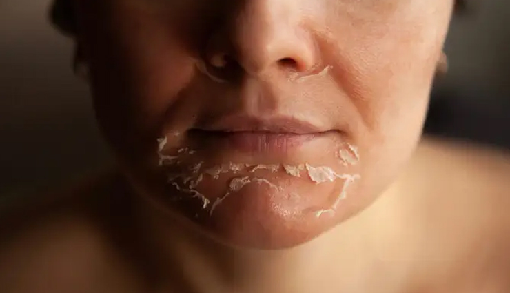 diy mango mask,mango mask for skin,skin care tips,beauty tips,beauty benefits of mango