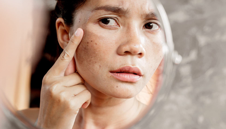 mango seed butter,mango seed butter for skin,beauty benefits of mango seed butter,skin care tips,beauty tips