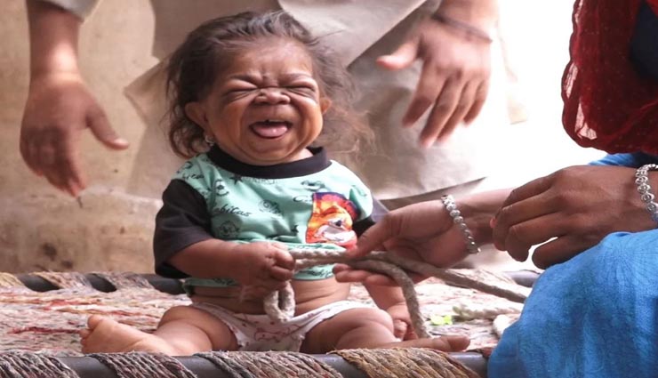 आखिर कैसे इस शख्स की बीमारी ने बनाया इसे पूजनीय, दूर से आशीर्वाद लेने आते हैं लोग