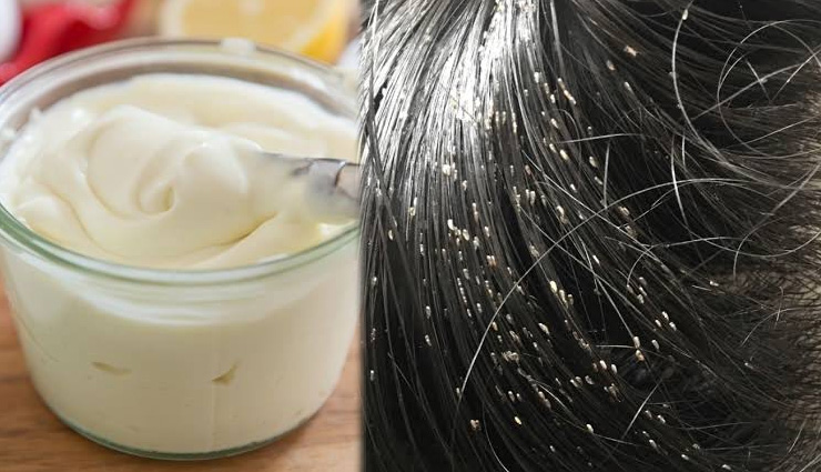 head lice,home remedies to get rid of head lice,lice problem,scalp care tips,scalp care,beauty,beauty tips