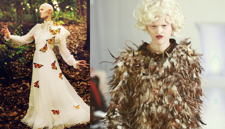 true meaning of beauty,ectodermal dysplasia,melanie gaydos,model,super model