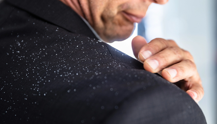 hair care tips for men,monsoon hair care tips for men,men care tips,men beauty tips,hair care tips