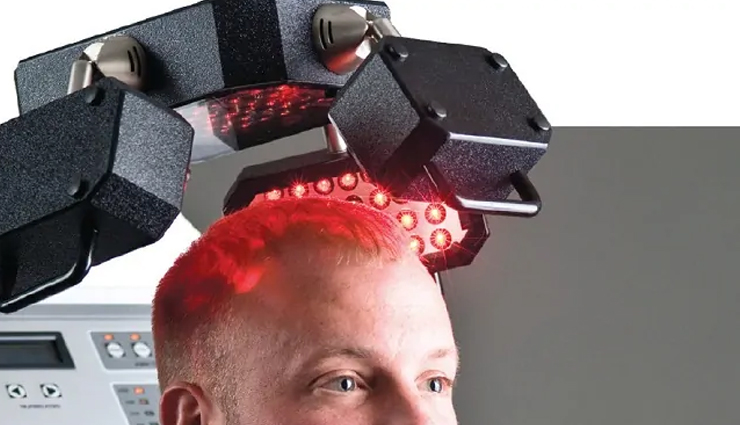 hair loss in men,treatment for hair loss in men,men hair care tips,hair care tips,beauty tips