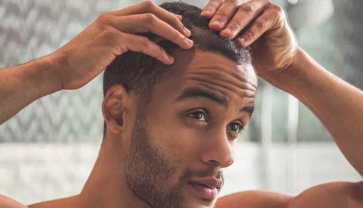 9 Scalp Conditions That Affect Men