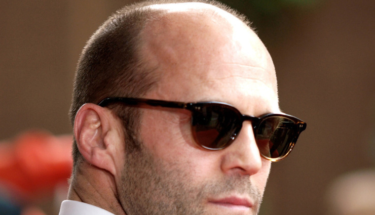 male pattern baldness,alopecia areata,seborrheic eczema,psoriasis,head lice,dandruff,ring worm,folliculitis,scalp conditions that affect men,men hair care tips,hair care tips,beauty tips,scalp care tips