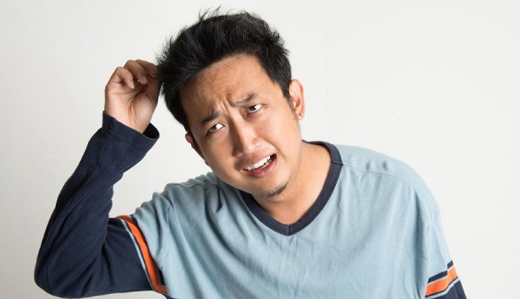 male pattern baldness,alopecia areata,seborrheic eczema,psoriasis,head lice,dandruff,ring worm,folliculitis,scalp conditions that affect men,men hair care tips,hair care tips,beauty tips,scalp care tips