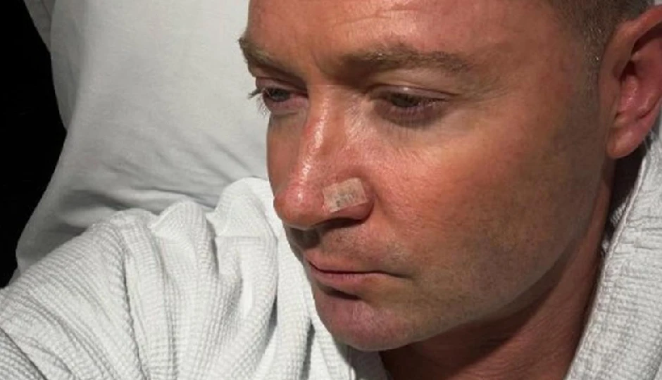 क्या लंबे समय तक धूप में रहने से माइकल क्लार्क को हुआ स्किन कैंसर? जानें इसके खतरे और बचाव के उपाय