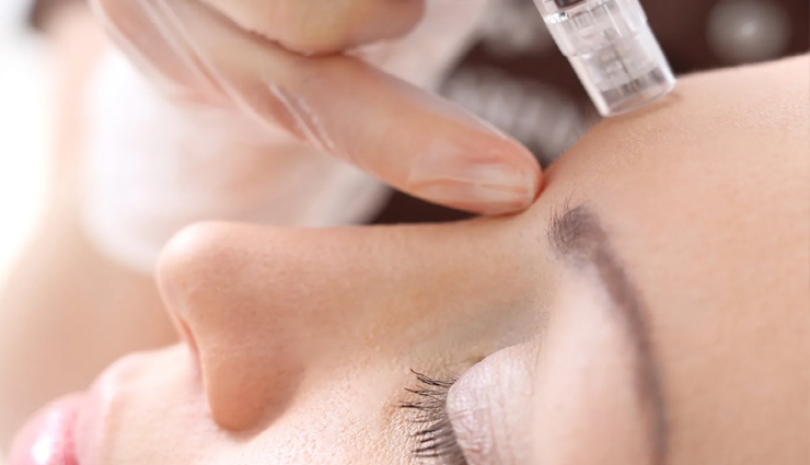 best treatments for maintaining your youthful appearance,beauty tips,beauty hacks