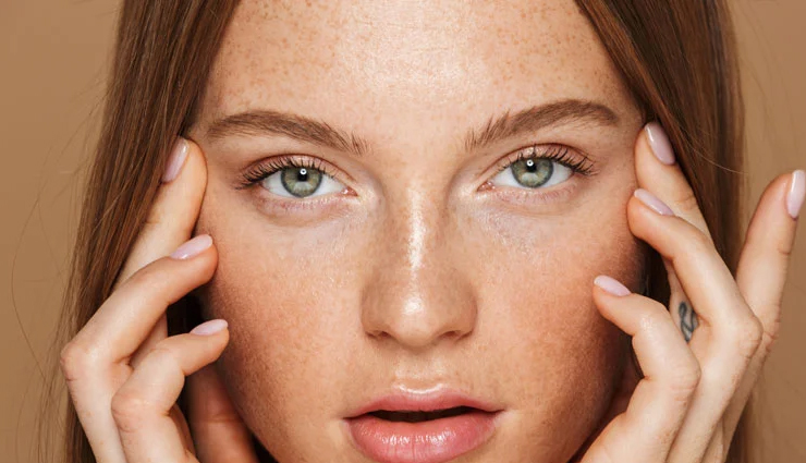 5 Best Home Remedies To Try for Milia