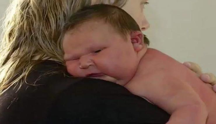 इस नवजात बच्ची को देख डॉक्टर भी हुए हैरान, मां ने कह डाला 'बेबी सूमो'