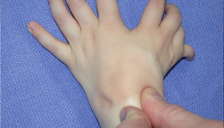 mirror hand syndrome diagnosis,treatment for mirror hand syndrome,mirror hand syndrome therapy,mirror hand syndrome rehabilitation,coping with mirror hand syndrome,mirror hand syndrome management,mirror hand syndrome prognosis,mirror hand syndrome symptoms,mirror hand syndrome causes,mirror hand syndrome specialist,mirror hand syndrome exercises,mirror hand syndrome physiotherapy,mirror hand syndrome research,mirror hand syndrome neurology,mirror hand syndrome rehabilitation exercises,mirror hand syndrome specialists,mirror hand syndrome physical therapy,coping strategies for mirror hand syndrome,mirror hand syndrome case studies,mirror hand syndrome prognosis and outlook,mirror hand syndrome surgical options,mirror hand syndrome therapies,mirror hand syndrome neurological disorder