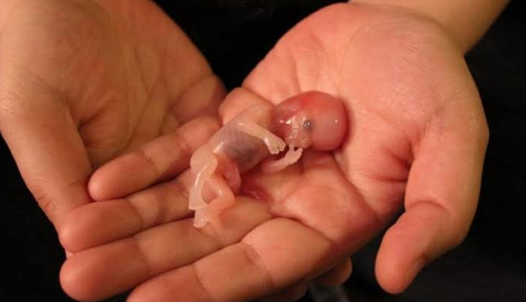 इन तीन महीनों में होता है मिसकैरेज का सबसे ज्याद खतरा, महिलाओं को जानना बेहद जरुरी