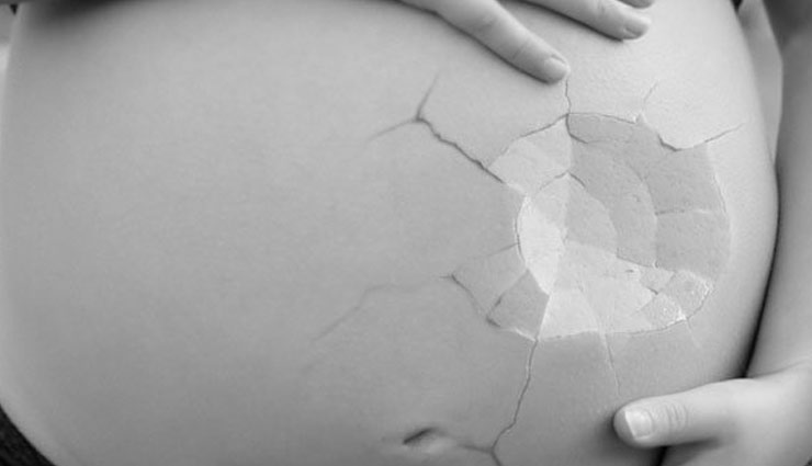 Health tips,miscarriage,Health,simple health tips