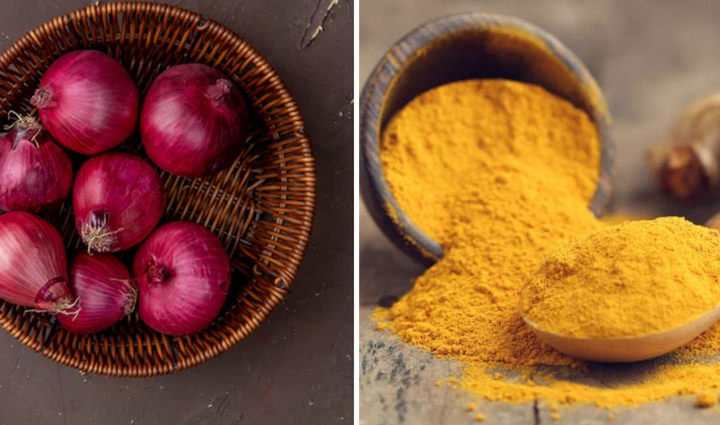 असहनीय पीड़ा का अहसास करवाती हैं मोंच, इन उपायों से मिलेगा जल्द आराम sprains make you feel unbearable pain these remedies will give you relief soon,Health,healthy living