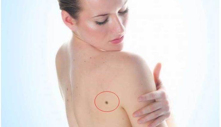 शरीर के इन हिस्सों में तिल दर्शाता हैं जीवन में धन, आइये जानें