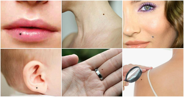 moles on body,moles astrology,astrology tips,different body parts ,चेहरे के ये तिल बताते हैं आपके बारे में 