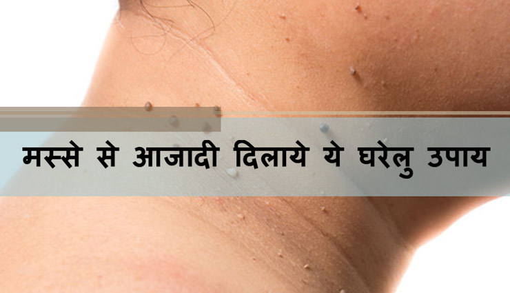 मस्से से आजादी दिलाये ये घरेलू उपाय