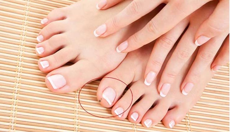 astrology tips,astrology tips in hindi,moles significance,mole shows money in life