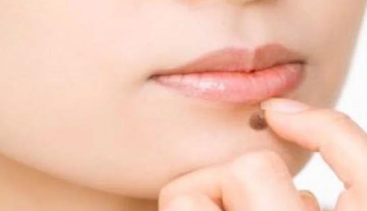 astrology tips,astrology tips in hindi,mole on body parts,mole indicates becoming rich