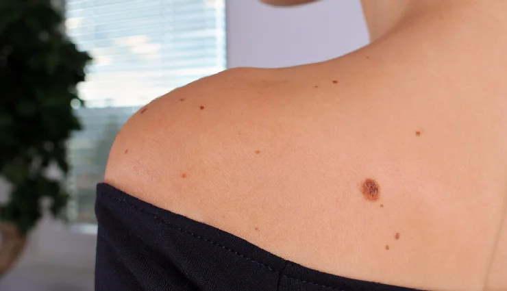 women health tips,warning signs for women,lifestyle diseases,diabetes symptoms,obesity risks,heart disease prevention,cancer early signs,women wellness,health awareness for women,prevent lifestyle diseases