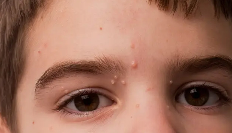 benefits of lemon myrtle leaves,lemon myrtle leaves benefits,lemon myrtle leaves healthy food,heath tips