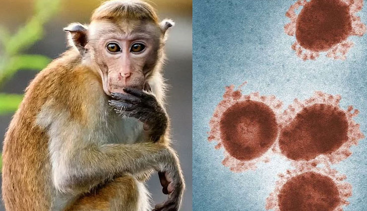 monkeypox cure,monkeypox cases,monkeypox symptoms,monkeypox virus,is monkeypox dangerous,monkeypox vaccine,monkeypox deadly,monkeypox death rate,monkeypox treatment in hindi
