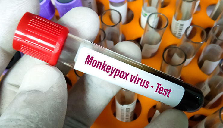 what does monkeypox do to humans,how does someone get monkeypox,does monkeypox go away,is monkeypox infectious,difference between chickenpox and monkeypox,what are the first signs of monkeypox,how many cases of monkeypox are there in india,what animals can carry monkeypox,what is the cure for monkeypox,how do you avoid getting monkeypox,what does cdc say about monkey pox,what does having monkeypox feel like,can you get monkeypox from hugging,why is it called monkeypox,is monkeypox dangerous,monkeypox origin,monkeypox vaccine,monkeypox cases,monkeypox symptoms,monkeypox pictures,monkeypox deadly,monkeypox cure