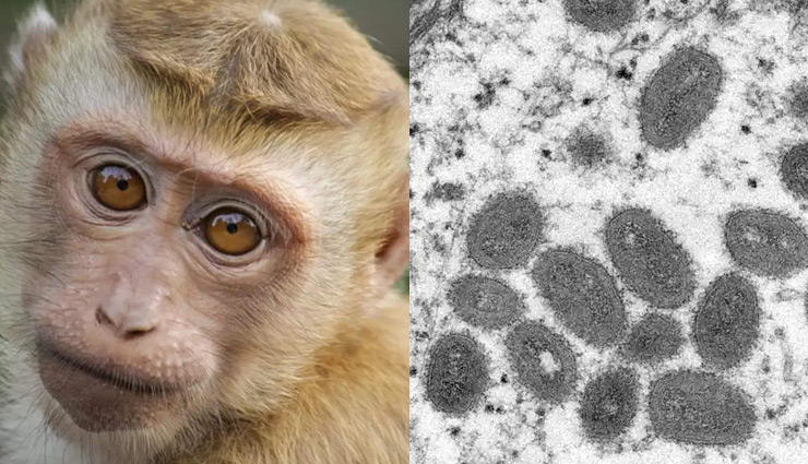 monkeypox virus,monkeypox,monkeypox infection,europe,what is monkeypox virus