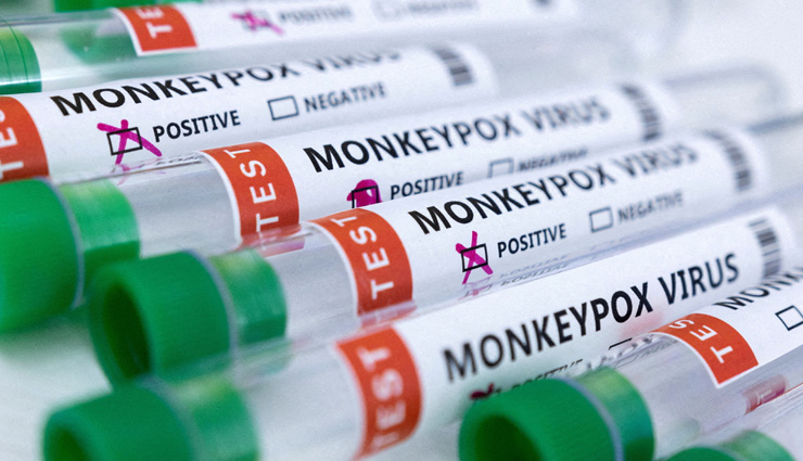 जितना सोचा था उससे ज्यादा फैल गया Monkeypox, अब तक मिले 8 मरीज, एक की मौत