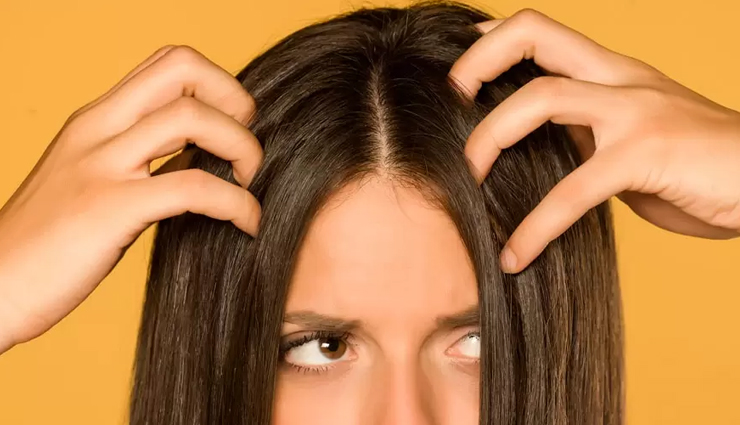 4 Natural Ways To Get Rid of Monsoon Dandruff