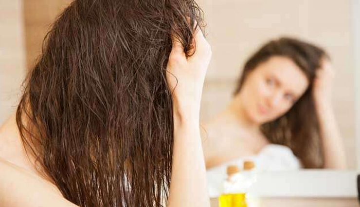 monsoon dandruff,home remedies for monsoon dandruff,hair care tips,beauty tips