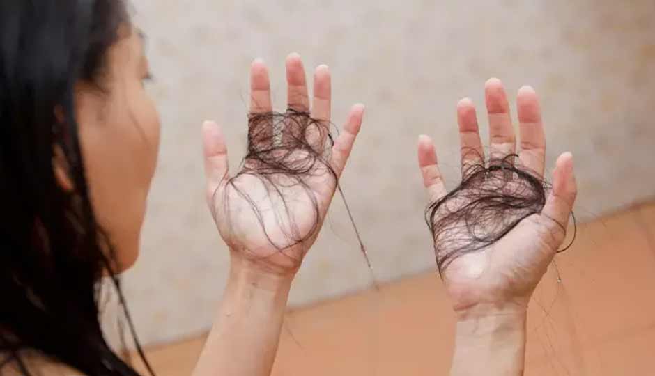 7 Home Remedies to Treat Monsoon Hair Fall Naturally
