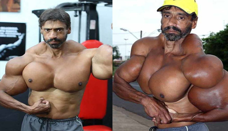 शराब-तेल का इंजेक्शन लगाकर बनाई ऐसी बॉडी, लोग कहने लगे मॉन्स्टर 