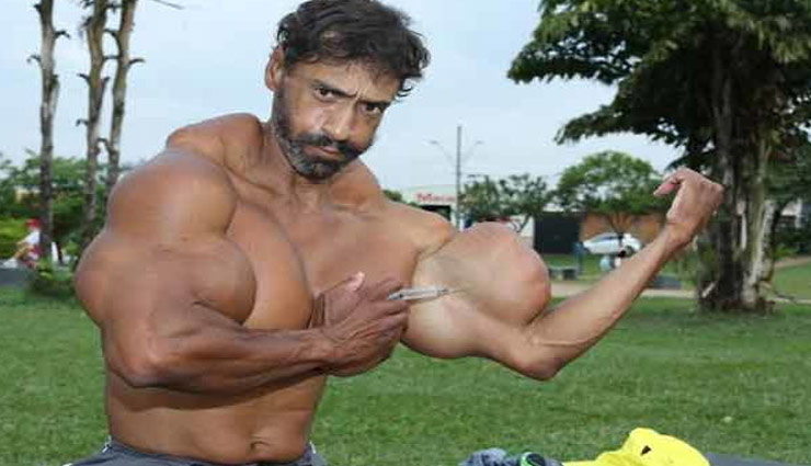 शराब-तेल का इंजेक्शन लगाकर बनाई ऐसी बॉडी, लोग कहने लगे मॉन्स्टर real hulk,injected oil,body,monster,wrestler,weird news in hindi