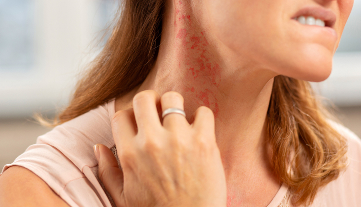 mung bean sprouts,harmful effects,excess consumption,food poisoning,bacterial contamination,salmonella,e coli,listeria,allergies,digestive problems,gas and bloating,diarrhea,nutrient absorption,oxalates,thyroid function,goitrogens,interference with iodine absorption,raw sprouts,cooking sprouts,safe consumption