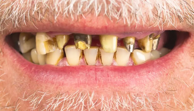 health benefits of mosambi,mosambi,Health tips,fitness tips