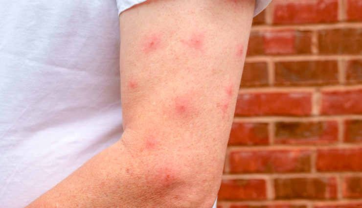 reasons why cassia essential oil is good for hair,beauty tips,beauty hacks