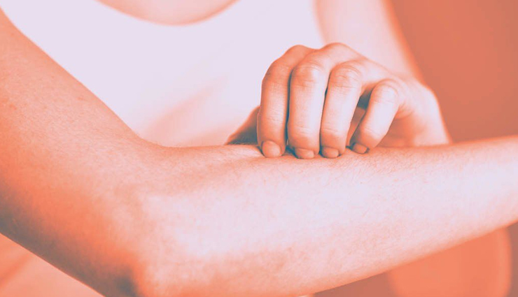 home remedies,home remedies for mosquito bites,mosquito bites,Health tips,fitness tips,summer tips