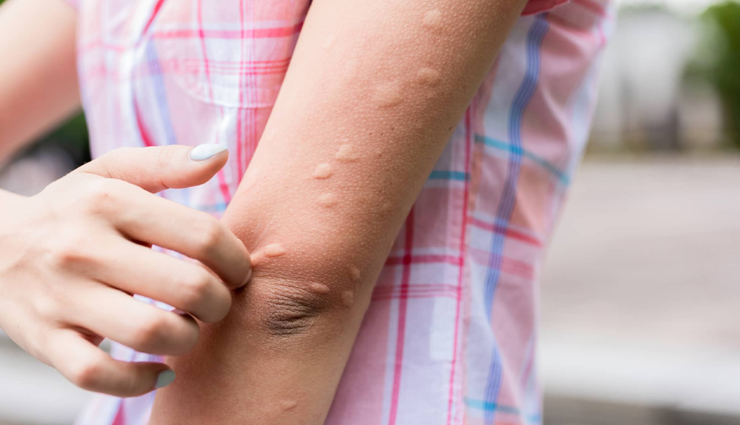 5 least known benefits of cassia essential oil for your skin and hair,Health,healthy living