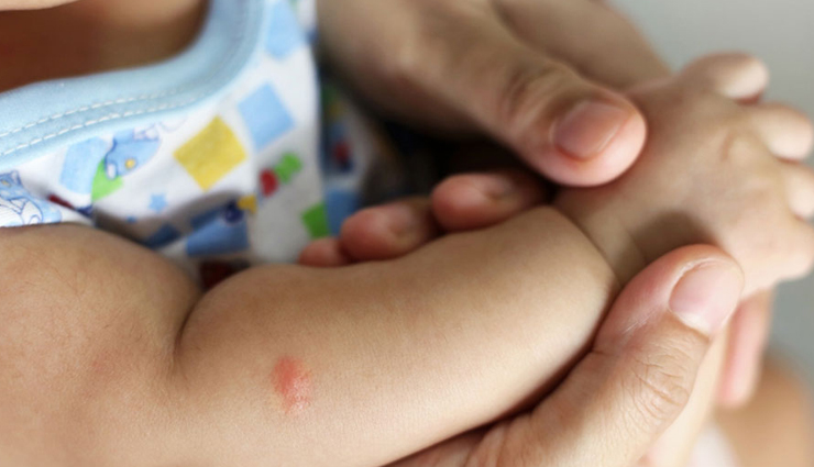 home remedies,home remedies for mosquito bites,mosquito bites,Health tips,fitness tips,summer tips