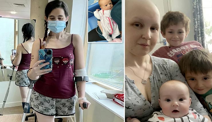 इस मां ने पेश की त्याग की अनोखी मिसाल, अजन्‍मे बच्‍चे को बचाने के लिए कटवा डाला अपना पैर, जानें वजह