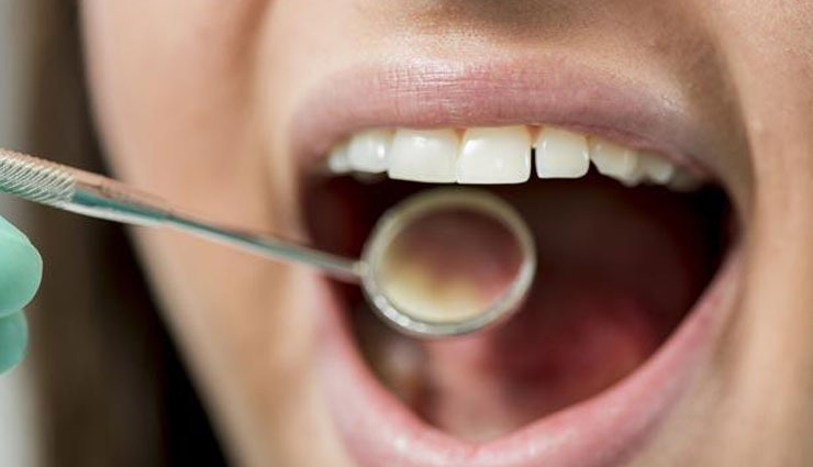 mouth cancer,symptoms of mouth cancer,cancer symptoms,Health tips,fitness tips