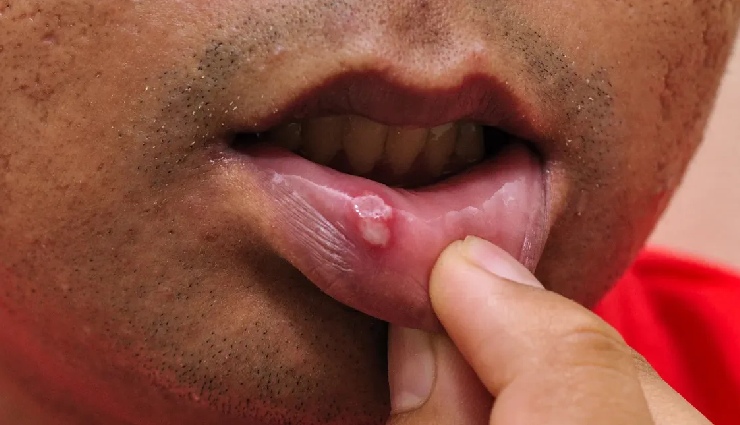 healthy fats,good fats benefits,essential fats,unsaturated fats,types of dietary fats,fats for brain function,omega-3 fatty acids,fats for heart health,linoleic acid,linolenic acid,healthy fat sources,saturated vs unsaturated fats,importance of fats in diet