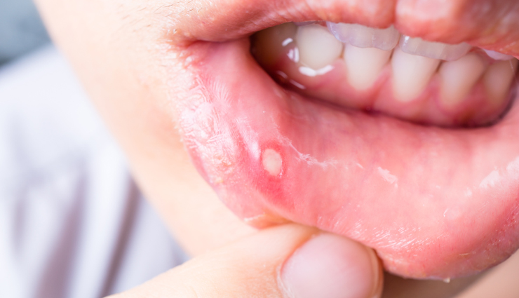 health benefits of gulkand,gulkand for digestion,cooling properties of gulkand,gulkand for skin,gulkand stress relief,natural laxative,ayurvedic gulkand,gulkand for oral health,gulkand menstrual relief,natural detoxification