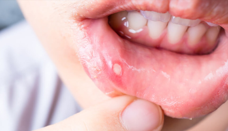 coriander,coriander good for health,coriander health benefits,health benefits of coriander,healthy food coriander,Health tips,Health